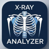 X-Ray Analyzer